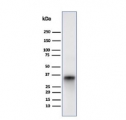Western blot testing of human Raji cell lysate with CD74 antibody (clone LN-2). Expected molecular weight: 33-43 kDa.