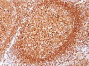 IHC testing of FFPE human tonsil stained with CD79a antibody (clone JCB117). Required HIER: boil tissue sections in pH 9 10mM Tris with 1mM EDTA for 10-20 min followed by cooling at RT for 20 minutes.