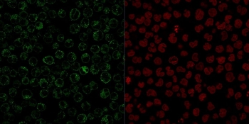 Immunofluorescent staining of PFA-fixed human Raji cells with CD79 antibody (clone JCB117, green) and Reddot nuclear stain (red).