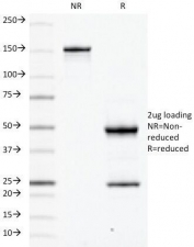 SDS-PAGE analysis of purified, BSA-free CD79a antibody (clone JCB117) as confirmation of integrity and purity.