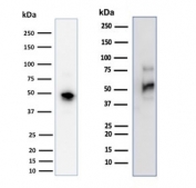 Western blot testing of two different lots of human Raji cell lysate with CD79a antibody (clone JCB117). Expected molecular weight: 25-47 kDa depending on glycosylation level.