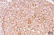 IHC testing of FFPE human tonsil (10X) stained with CD79a antibody (clone HM47/A9).