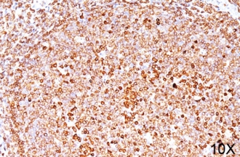 IHC testing of FFPE human tonsil (10X) stained with CD79a antibody (clone HM47/A9).~