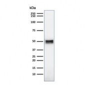 Western blot testing of human Raji cell lysate with CD79a antibody (clone HM47/A9). Expected molecular weight: 25-47 kDa depending on glycosylation level.