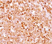 IHC testing of FFPE human tonsil (10X) stained with CD79a antibody cocktail (clone JCB117 + HM47/A9).