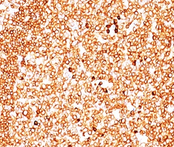 IHC testing of FFPE human tonsil (10X) stained with CD79a antibody cocktail (clone JCB117 + HM47/A9).