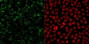 Immunofluorescent staining of PFA-fixed human Raji cells with CD79a antibody cocktail (clone JCB117 + HM47/A9, green) and Reddot nuclear stain (red).