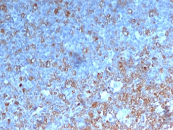 IHC testing of human tonsil stained with CDK1 antibody.~