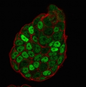 Immunofluorescent staining of PFA-fixed human MCF7 cells with p27Kip1 antibody (clone SX53G8, green) and Phalloidin (red).