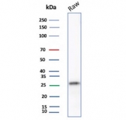 Western blot testing of mouse RAW264.7 cell lysate with p27Kip1 antibody. Expected molecular weight ~27 kDa.