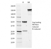 SDS-PAGE analysis of purified, BSA-free CEA antibody (clone COL-1) as confirmation of integrity and purity.