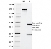 SDS-PAGE analysis of purified, BSA-free CEA antibody (clone CEA31) as confirmation of integrity and purity.