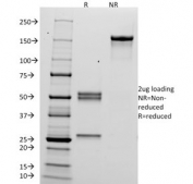 SDS-PAGE analysis of purified, BSA-free hCG alpha antibody (clone HCGa/53) as confirmation of integrity and purity.