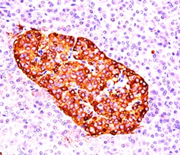 IHC testing of pancreas stained with chromogranin A antibody (CGA414).