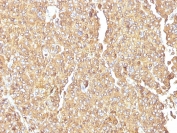 IHC testing of FFPE human adrenal gland with Chromogranin A antibody. HIER: boil tissue sections in pH6, 10mM citrate buffer, for 20 min and allow to cool before testing.