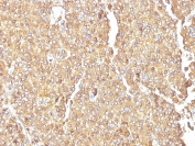 IHC testing of FFPE human adrenal gland with Chromogranin A antibody. HIER: boil tissue sections in pH6, 10mM citrate buffer, for 20 min and allow to cool before testing.