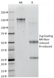 SDS-PAGE Analysis of Purified, BSA-Free CD35 Antibody (clone E11). Confirmation of Integrity and Purity of the Antibody.