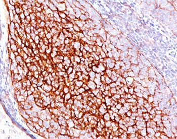 IHC testing of human tonsil stained with CD35 antibody (E11). Note cell membrane staining.~