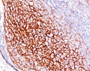 CD35 antibody E11 immunohistochemistry
