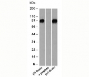 Western blot testing of human and mouse samples using beta-Catenin antibody. Predicted molecular weight ~85 kDa, but routinely observed at 90-95 kDa.