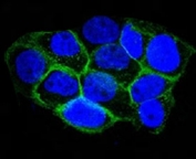 Immunofluorescent staining of A431 cells with Alexa Fluor conjugated EGFR antibody (green, clone GFR450) and DAPI nuclear stain (blue).