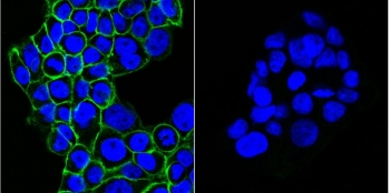 Left: Immunofluorescent staining of human A431 cells with CF488-conjugated EGFR antibody (clone GFR450, green) and DAPI nuclear stain (blue). Right: isotype control.