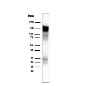 Western blot testing of A431 lysate using EGFR antibody at 1ug/ml.