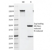 SDS-PAGE analysis of purified, BSA-free HER2 antibody (clone HRB2/451) as confirmation of integrity and purity.