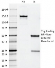 SDS-PAGE Analysis of Purified, BSA-Free ErbB2 Antibody (clone HRB2/258). Confirmation of Integrity and Purity of the Antibody.