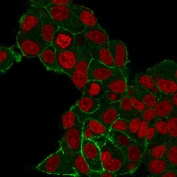 Immunofluorescent staining of PFA-fixed human MCF7 cells with HER2 ErbB2 antibody (clone HRB2/282, green) and Reddot nuclear stain (red).