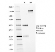 SDS-PAGE analysis of purified, BSA-free HER2 ErbB2 antibody (clone HRB2/282) as confirmation of integrity and purity.