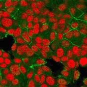 Immunofluorescent staining of PFA-fixed human MCF7 cells with HER2 ErbB2 antibody (clone HRB2/718, green) and Reddot nuclear stain (red).