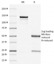 SDS-PAGE analysis of purified, BSA-free Estrogen Receptor antibody (clone ER505) as confirmation of integrity and purity.