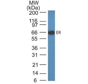 Western blot testing of human MCF7 cell lysate with Estrogen Receptor antibody (ER505). Predicted molecular weight ~67 kDa.~