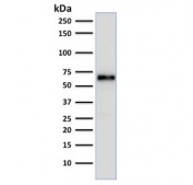 Western blot testing of MCF-7 cell lysate with ER antibody (clone ER506). Predicted molecular weight of ER alpha: ~67 kDa.