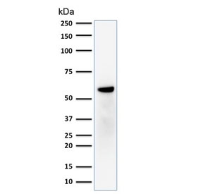Western blot testing of human MCF7 cell lysate with Estrogen Receptor beta antibody (clone ERb455). Expected molecular weight: 53-59 kDa.