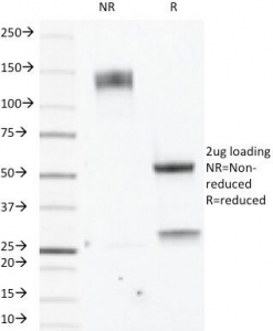 SDS-PAGE analysis of purified, BSA-free Estrogen Receptor beta antibody (clone ERb455) as confirmation of integrity and purity.