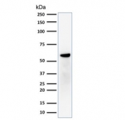 Western blot testing of human MCF7 cell lysate with Estrogen Receptor beta antibody (clone ERb455). Expected molecular weight: 53-59 kDa.