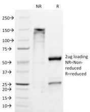 SDS-PAGE Analysis of Purified, BSA-Free Melan-A Antibody (clone M2-9E3). Confirmation of Integrity and Purity of the Antibody.