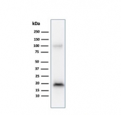 Western blot testing of human COLO-38 cell lysate with Melan-A antibody (clone M2-9E3). Expected molecular weight ~20 kDa with possible doublet.