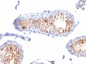 IHC testing of FFPE testis tissue with MART-1 antibody cocktail (clones A103 + M2-7C10 + M2-9E3).