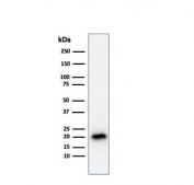 Western blot testing of human COLO-38 cell lysate with recombinant Melan-A antibody (clone A103). Expected molecular weight ~20 kDa with possible doublet.