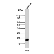 Western blot testing of human COLO-38 cell lysate with recombinant Melan-A antibody (clone A103). Expected molecular weight ~20 kDa with possible doublet.