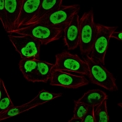 Immunofluorescent staining of paraformaldehyde fixed human HeLa cells with Ku70 + Ku80 antibody (clone KU729, green) and Phalloidin cell membrane stain (red). 
