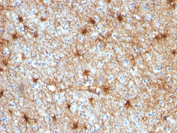 IHC staining of FFPE human cerebellum with GFAP antibody (clone GA-5).~