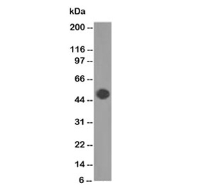 Western blot testing of human brain lysate GFAP antibody (clone GA-5). Predicted molecular weight ~50 kDa.