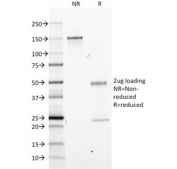 SDS-PAGE analysis of purified, BSA-free GFAP antibody (clone GA-5) as confirmation of integrity and purity.