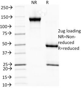 SDS-PAGE analysis of purified, BSA-free HSP27 antibody (clone G3.1) as confirmation of integrity and purity.