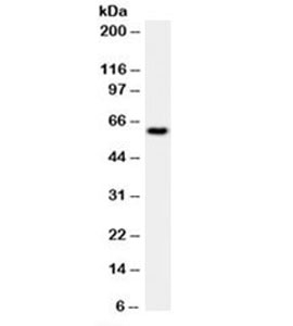 Western blot testing of HeLa cell lysate with HSP60 antibody (clone LK1).