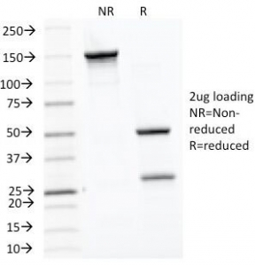 SDS-PAGE Analysis of Purified, BSA-Free HSP60 Antibody (clone LK1). Confirmation of Integrity and Purity of the Antibody.